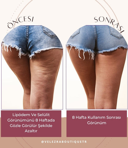 Velezra Şekillendirici Toparlayıcı Selülit Giderici Şort Korse